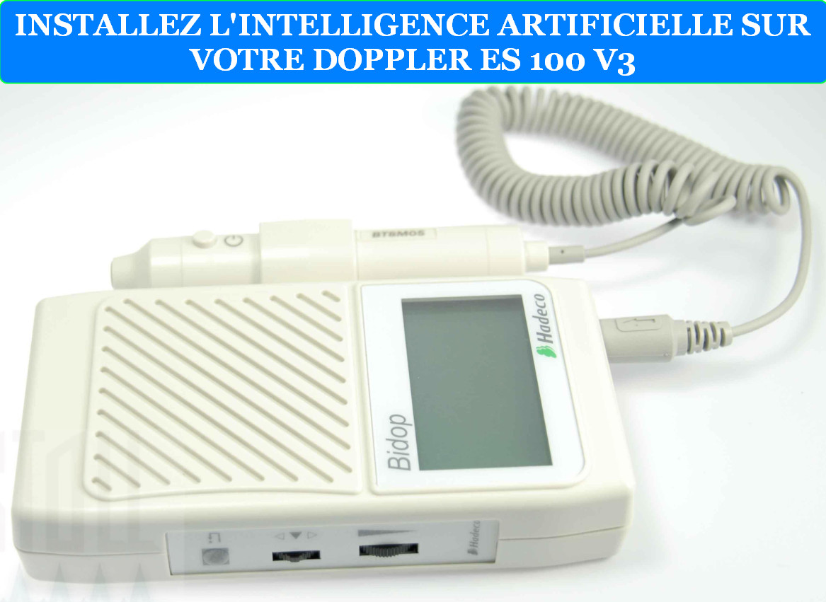 INSTALLEZ L'INTELLIGENCE ARTIFICIELLE SUR VOTRE DOPPLER ES 100 V3