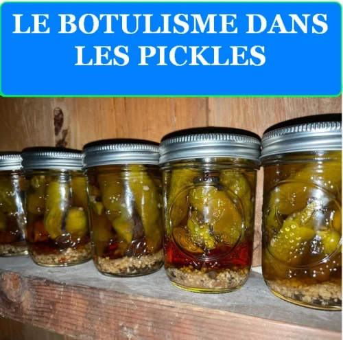 LE BOTULISME DANS LES PICKLES : RISQUES, PREVENTION ET BONNES PRATIQUES 2 LIRE LA SUITE À PROPOS DE L’ARTICLE LE BOTULISME DANS LES PICKLES : RISQUES, PREVENTION ET BONNES PRATIQUES