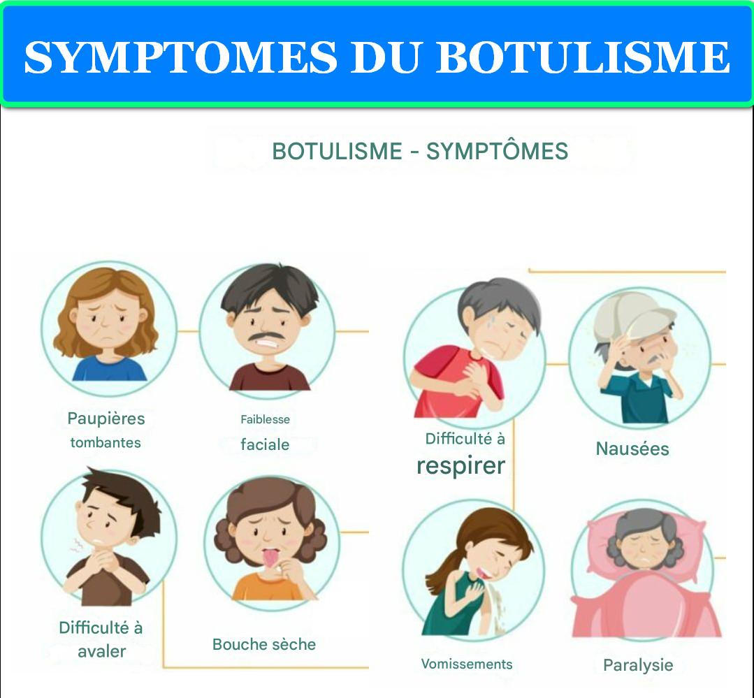 SYMPTÔMES DU BOTULISME 1 SYMPTOMES DU BOTULISME