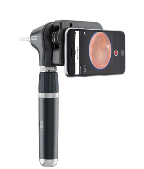 DISPOSITIFS WELCH ALLYN CLOUD/AI COMPATIBLES 1 71-XM3LXU OTOSCOPE MACROVIEW